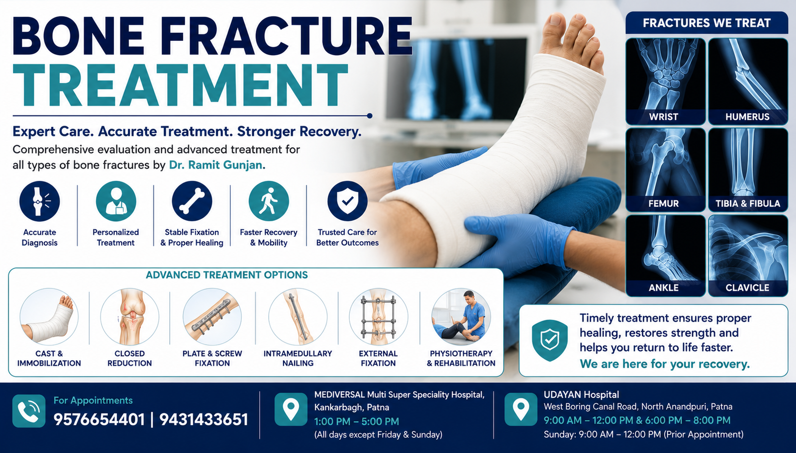 bone fracture treatment
